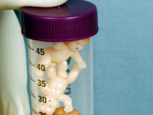 培养箱